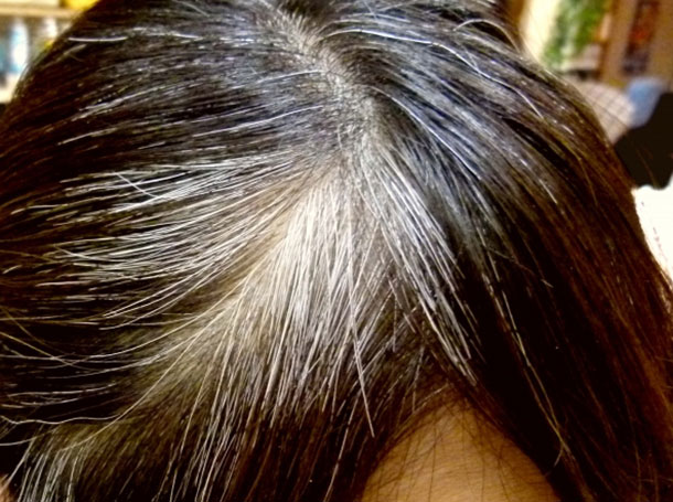 気が付くと増える 白髪の原因と対処法教えます 人には聞きにくい女性の薄毛や髪の悩み Vol 4 Domo ドーモプラス